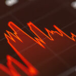 Stocks Graph